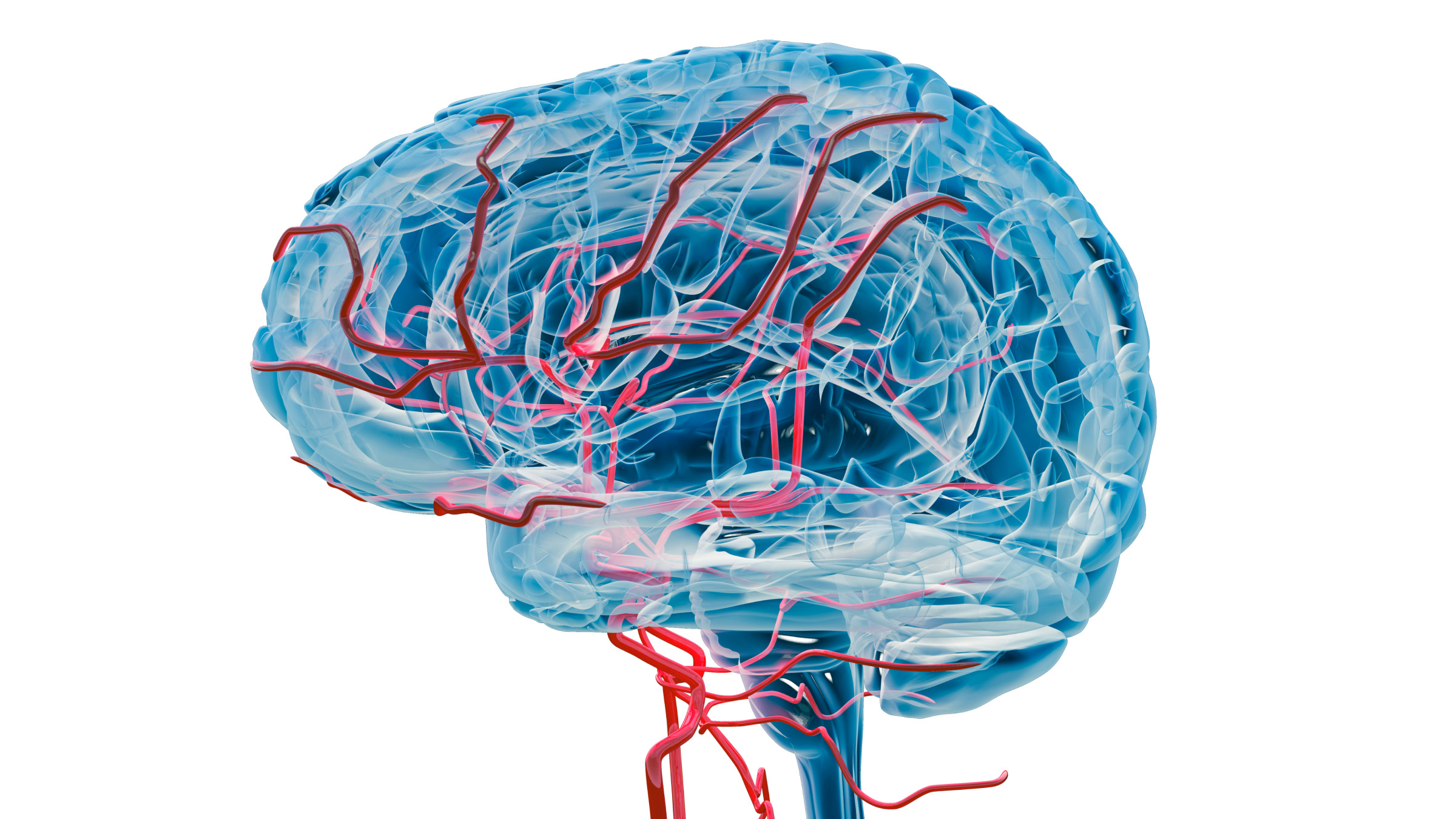 X-ray image of brain circulatory system