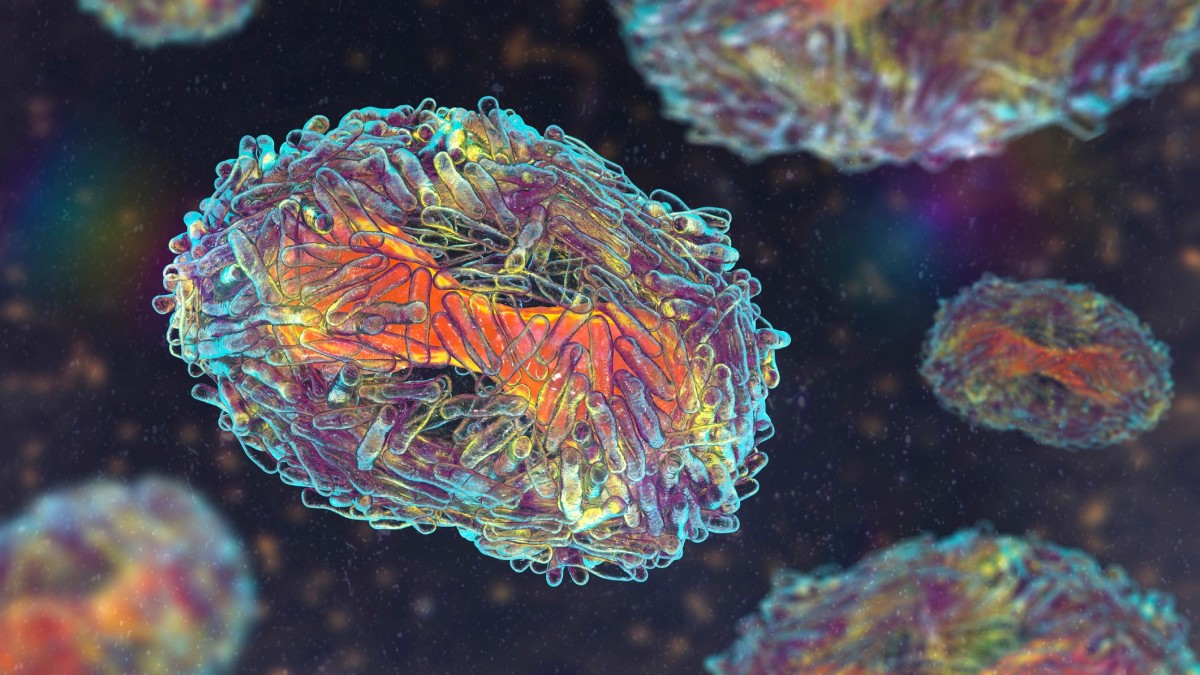 A colorized image of monkeypox cells in shades of orange and teal. 
