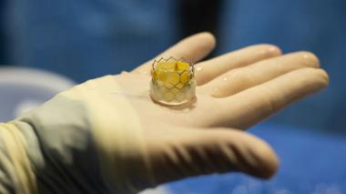 A gloved hand holds an artificial heart valve.  Blue surgical drapes are in the background.