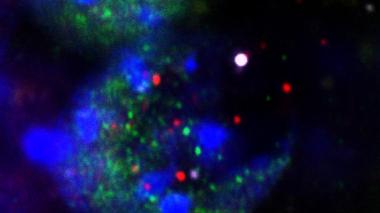 This image shows fragments released from the nuclei of neurons undergoing DNA damage during learning: DNA (large white dot at center right), histones (purple) and transcription factors (red and green). Credit: Radulovic lab