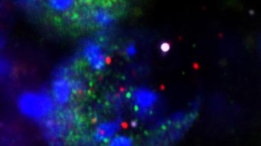 This image shows fragments released from the nuclei of neurons undergoing DNA damage during learning: DNA (large white dot at center right), histones (purple) and transcription factors (red and green). Credit: Radulovic lab