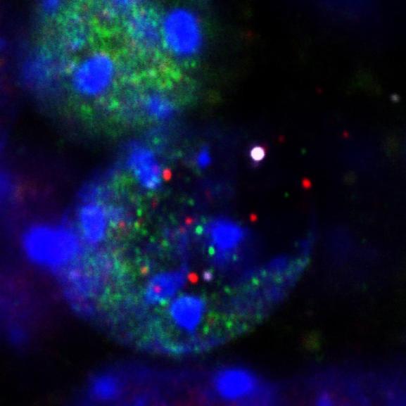 This image shows fragments released from the nuclei of neurons undergoing DNA damage during learning: DNA (large white dot at center right), histones (purple) and transcription factors (red and green). Credit: Radulovic lab