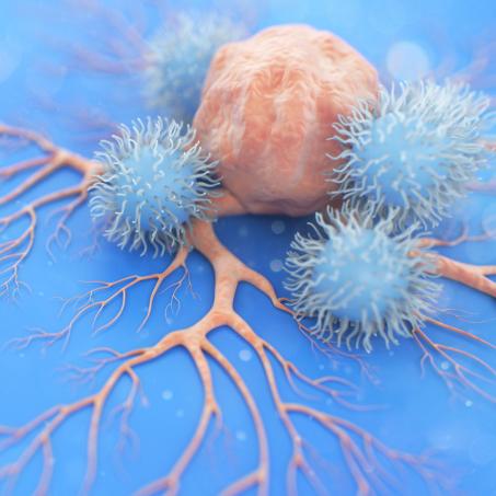 Artist's rendition of immune cells attacking a cancer cell